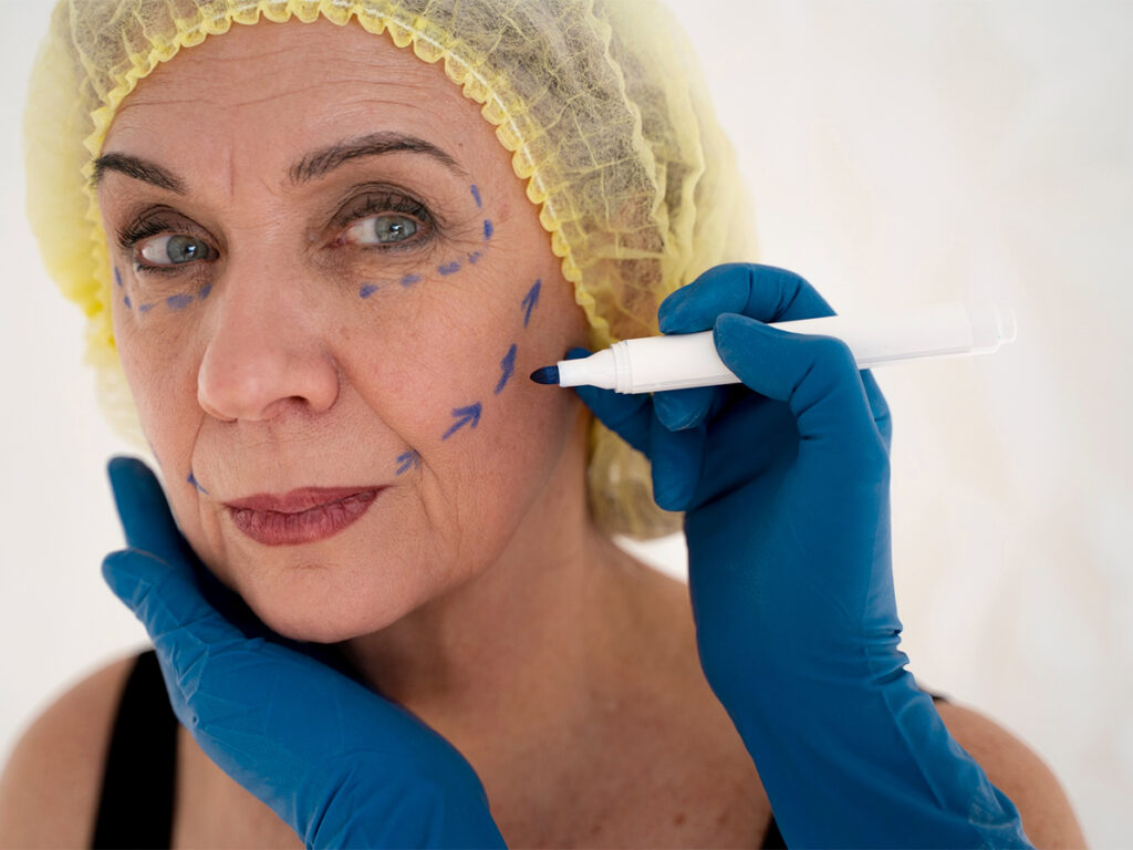 Non-Surgical Skin Tightening Treatments in Ontario