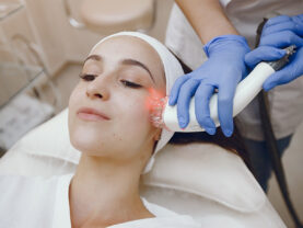 Pigmentation and Sun Damage in Ontario